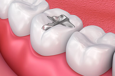 Albee Dental Care | TMJ Disorders, Oral Cancer Screening and Dental Cleanings