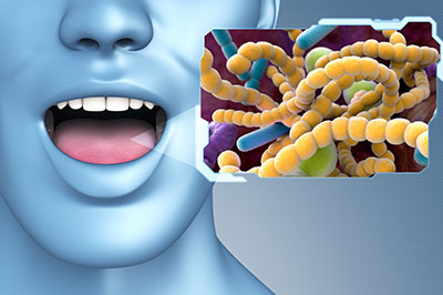 Albee Dental Care | Fluoride Treatment, TMJ Disorders and Oral Exams