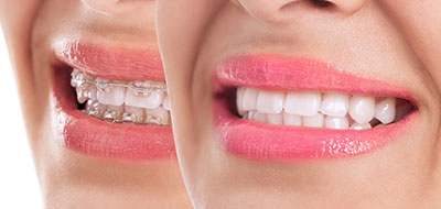 Albee Dental Care | Emergency Treatment, Night Guards and Root Canals